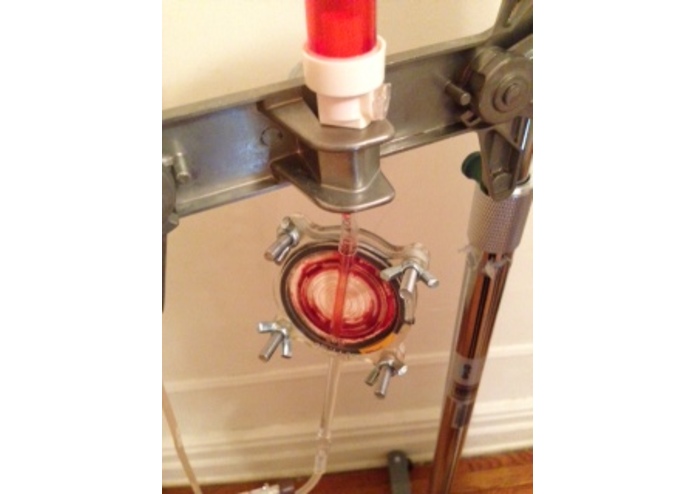 Blood Filter – screenshot 3