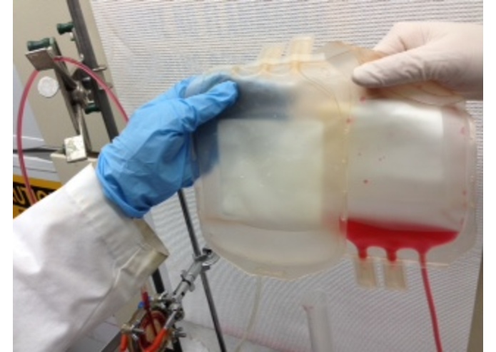 Blood Filter – screenshot 4