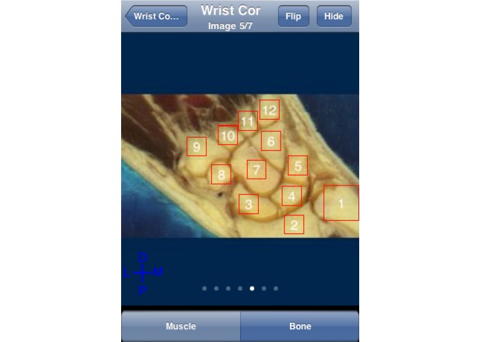 iJoints – screenshot 5