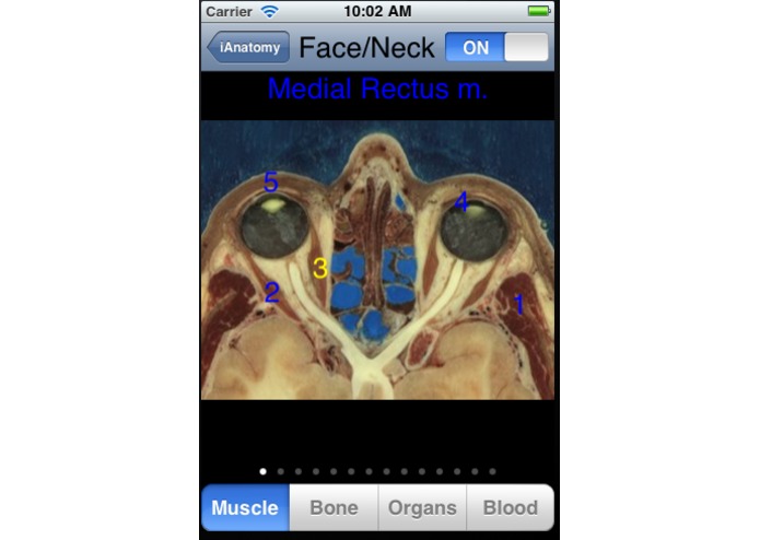 iAnatomy – screenshot 3