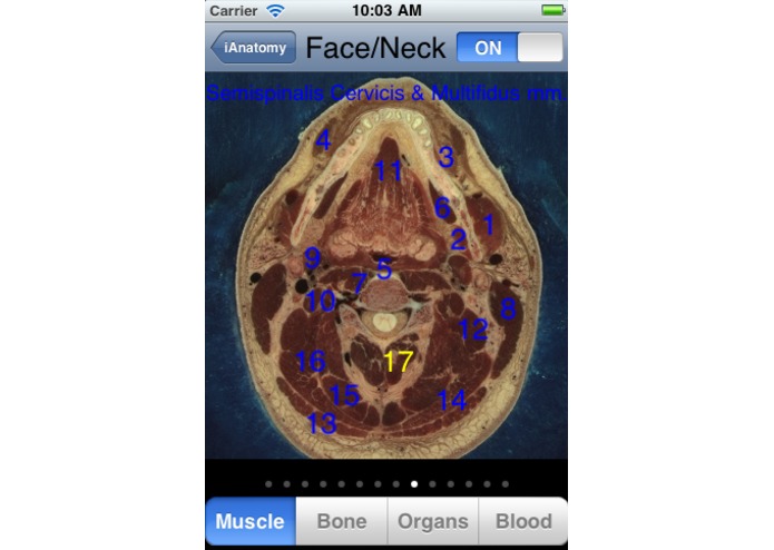 iAnatomy – screenshot 5