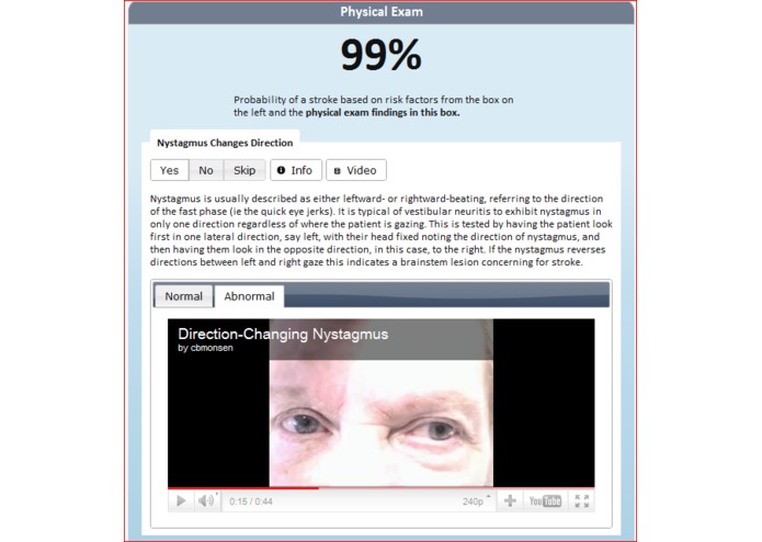 Dizziness Diagnostic Tool – screenshot 3