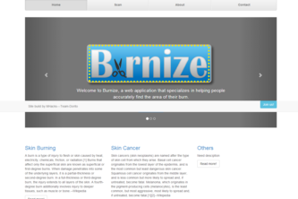 Burnize