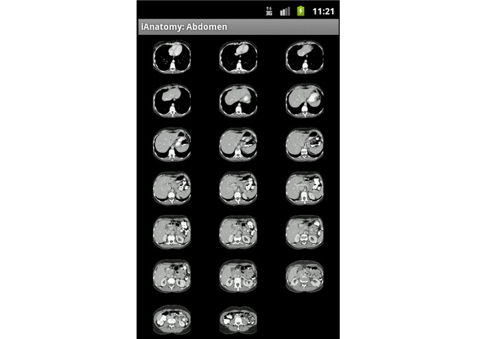 iAnatomy – screenshot 2