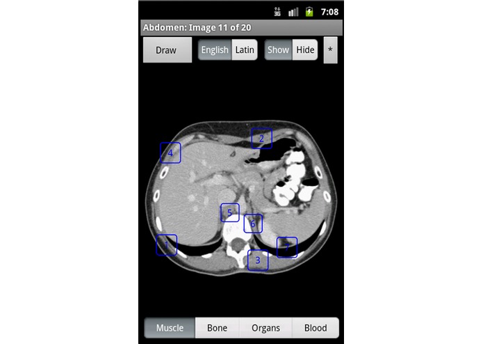 iAnatomy – screenshot 3