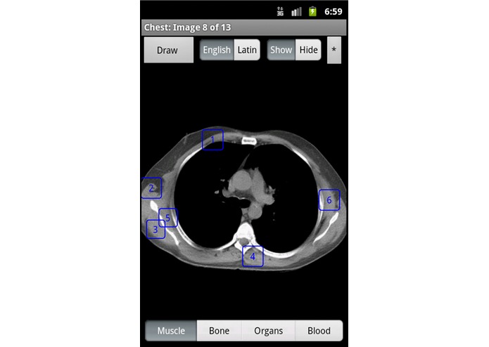 iAnatomy – screenshot 4