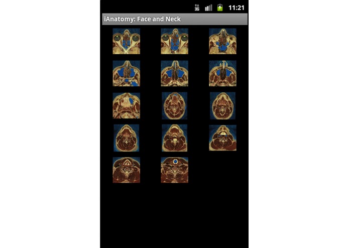 iAnatomy – screenshot 5