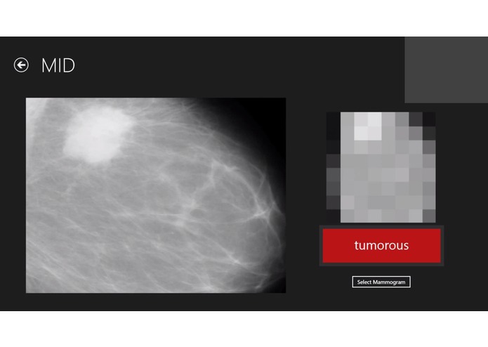 Breast Cancer Diagnostics – screenshot 3