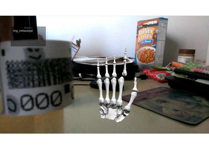 Medical Augmented Reality – screenshot 1