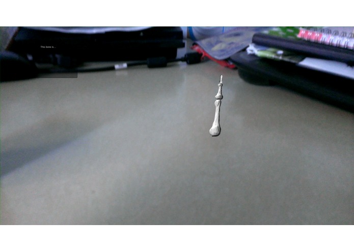 Medical Augmented Reality – screenshot 2