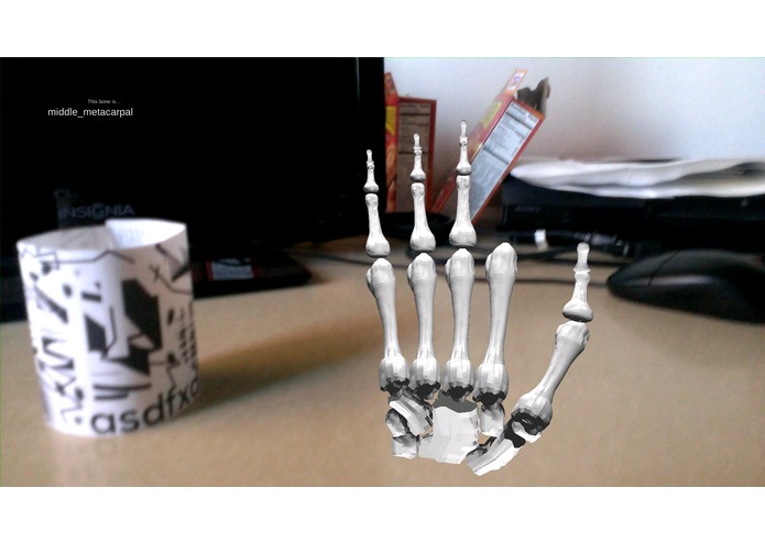Medical Augmented Reality – screenshot 3
