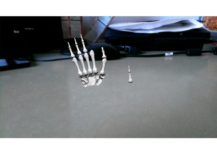 Medical Augmented Reality – screenshot 4