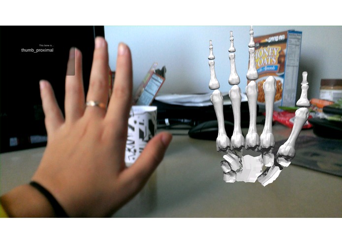Medical Augmented Reality – screenshot 5
