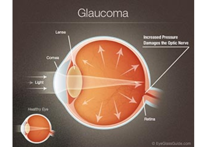 Fundux – screenshot 2