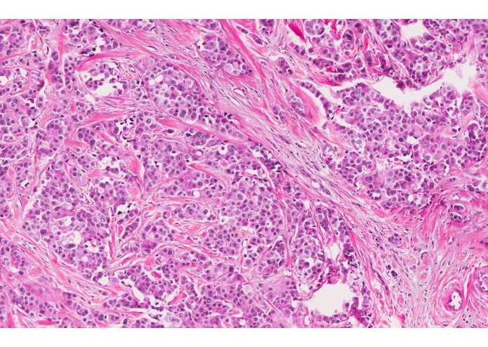 SVM Model for Accurate Breast Cancer Prognosis – screenshot 2