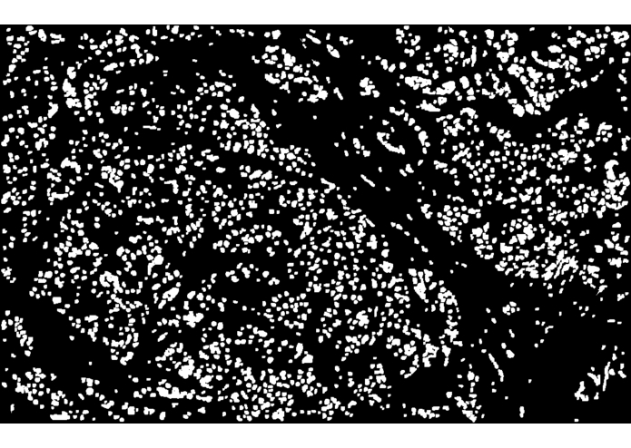 SVM Model for Accurate Breast Cancer Prognosis – screenshot 3