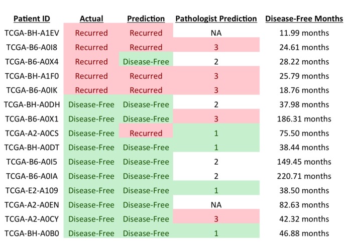 SVM Model for Accurate Breast Cancer Prognosis – screenshot 6