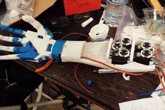 Leap Motion Controlled-Prosthetic Arm
