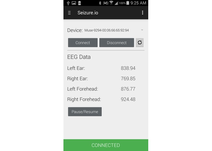 Seizure.io – screenshot 1