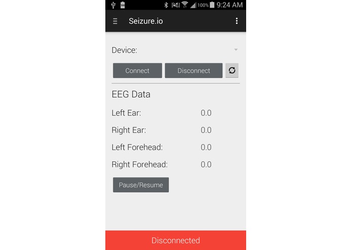 Seizure.io – screenshot 2