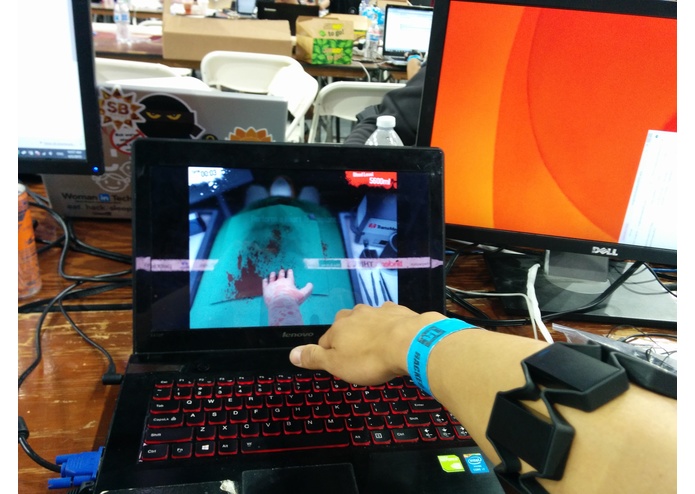 myo-surgery-sim – screenshot 1