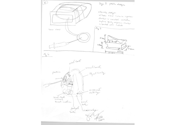 Adjustable Thyroplasty Implant – screenshot 1
