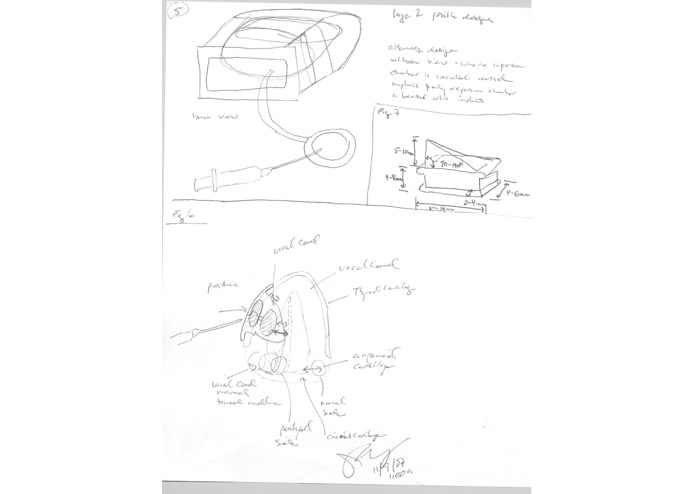 Adjustable Thyroplasty Implant – screenshot 1