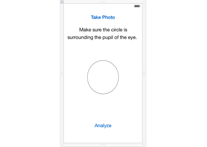 Cataract Detector – screenshot 1