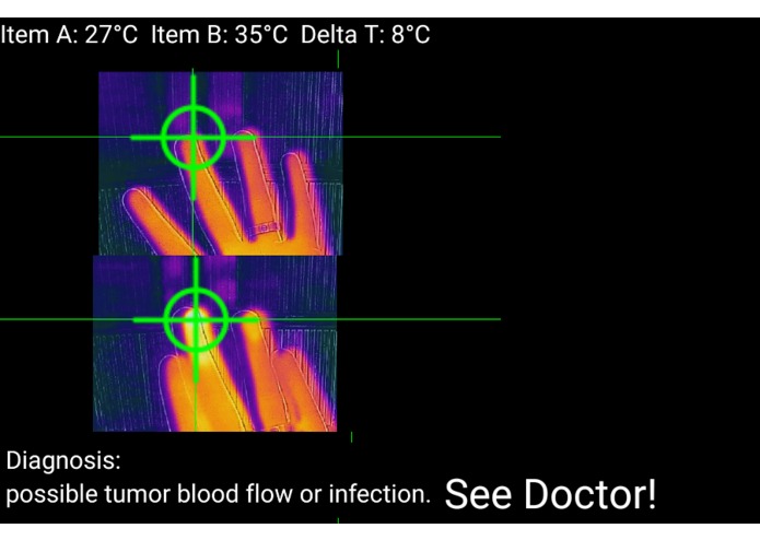 Nurse Therma – screenshot 5