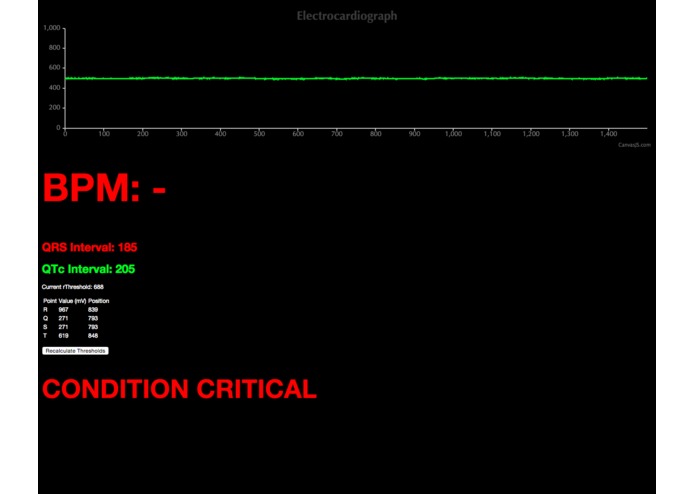 EKG – screenshot 1