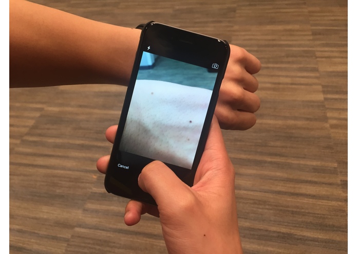 SkinSense – screenshot 2