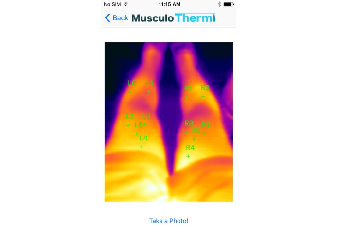 MusculoTherm – screenshot 3