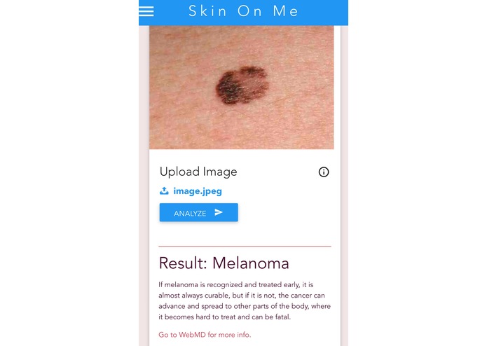 Skin On Me – screenshot 6