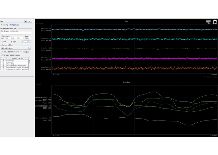 BrainRadio – screenshot 2