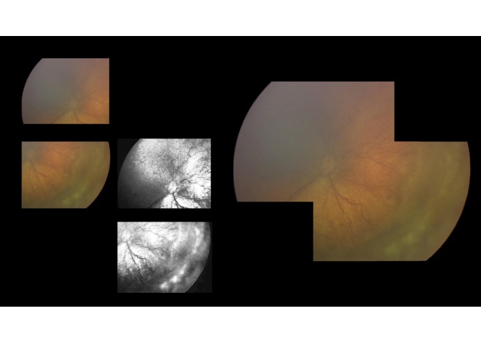 Kaleyedos – screenshot 2