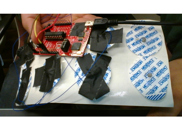 Remote ECG Heart Monitor – screenshot 2