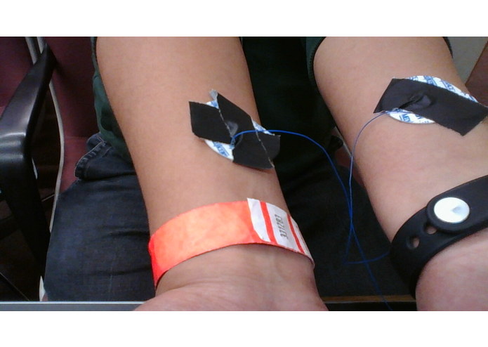 Remote ECG Heart Monitor – screenshot 3