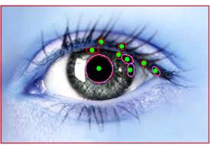Eyezheimer – screenshot 4