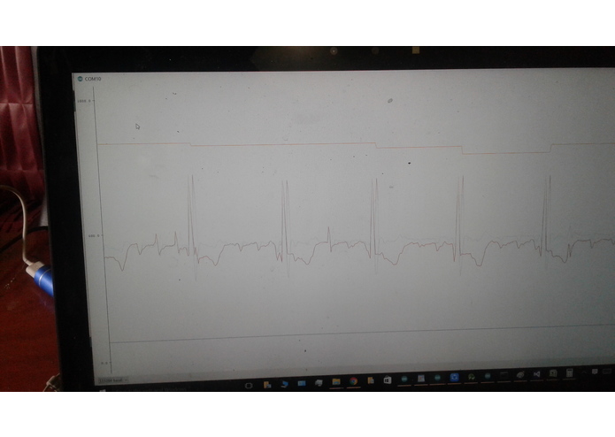 CARdialysis-Heart Monitoring Car Dashboard – screenshot 4