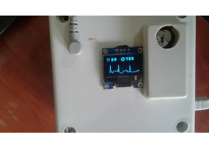 CARdialysis-Heart Monitoring Car Dashboard – screenshot 6