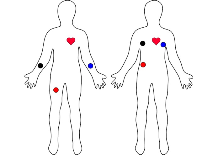 CARdialysis-Heart Monitoring Car Dashboard – screenshot 10