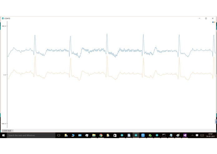 CARdialysis-Heart Monitoring Car Dashboard – screenshot 15