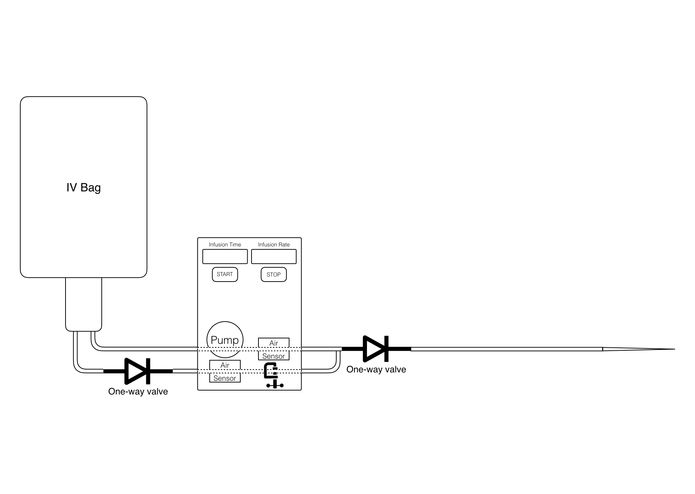 Automated IV Pump Occlusion Alleviation – screenshot 2