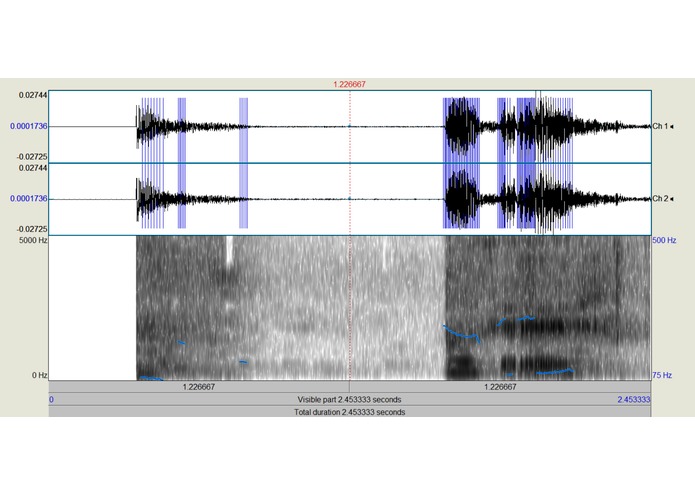 ParkinsonsDetector – screenshot 1