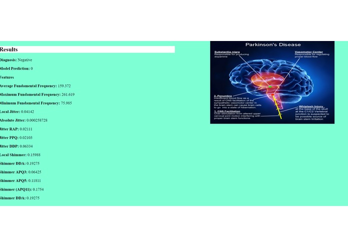 ParkinsonsDetector – screenshot 5