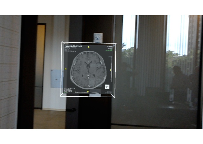 Holoframe Display for medical images – screenshot 1