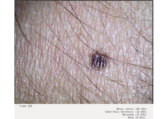 Doctor Hazel – screenshot 1