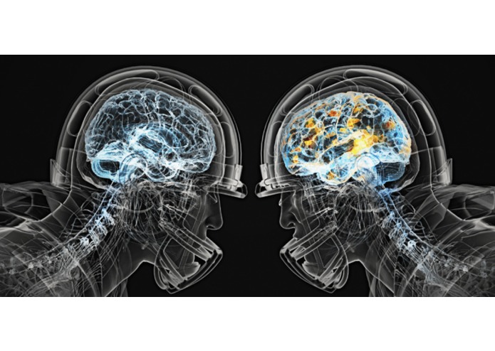 Brain Watch – screenshot 5