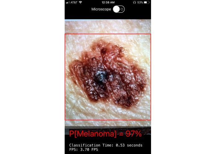 Melano.me – screenshot 1