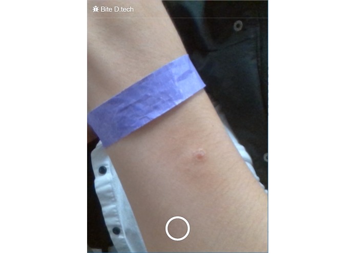 Bite D.tech – screenshot 1